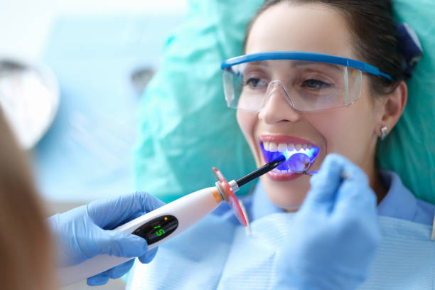 Composite Dental Bonding
