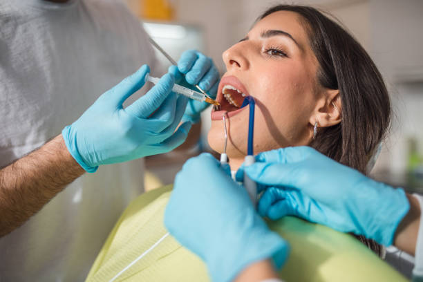 Tooth-Colored Fillings