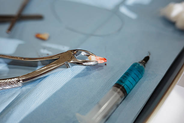 Bloody Tooth in Forceps – Dental Surgery Concept