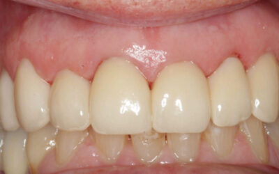 More Than a Smile Makeover: A Patient’s Journey to Renewed Confidence