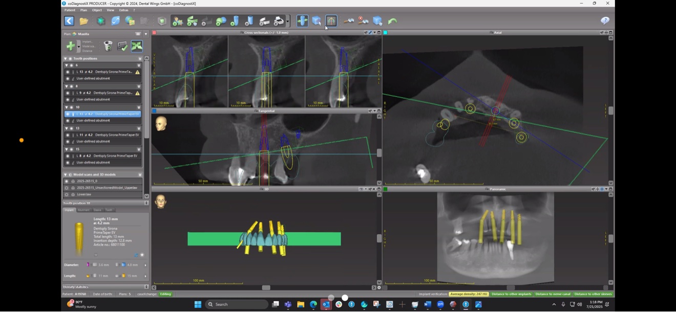 Implant planning software showing cross-sections and implant positions